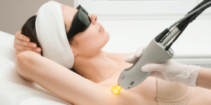 Smooth Skin For Valentine's Day: Why Laser Hair Removal Is the Ultimate Gift