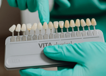 Veneers vs. Crowns Dr. Monica Boniadi Discusses What Laguna Hills, CA Residents Should Know