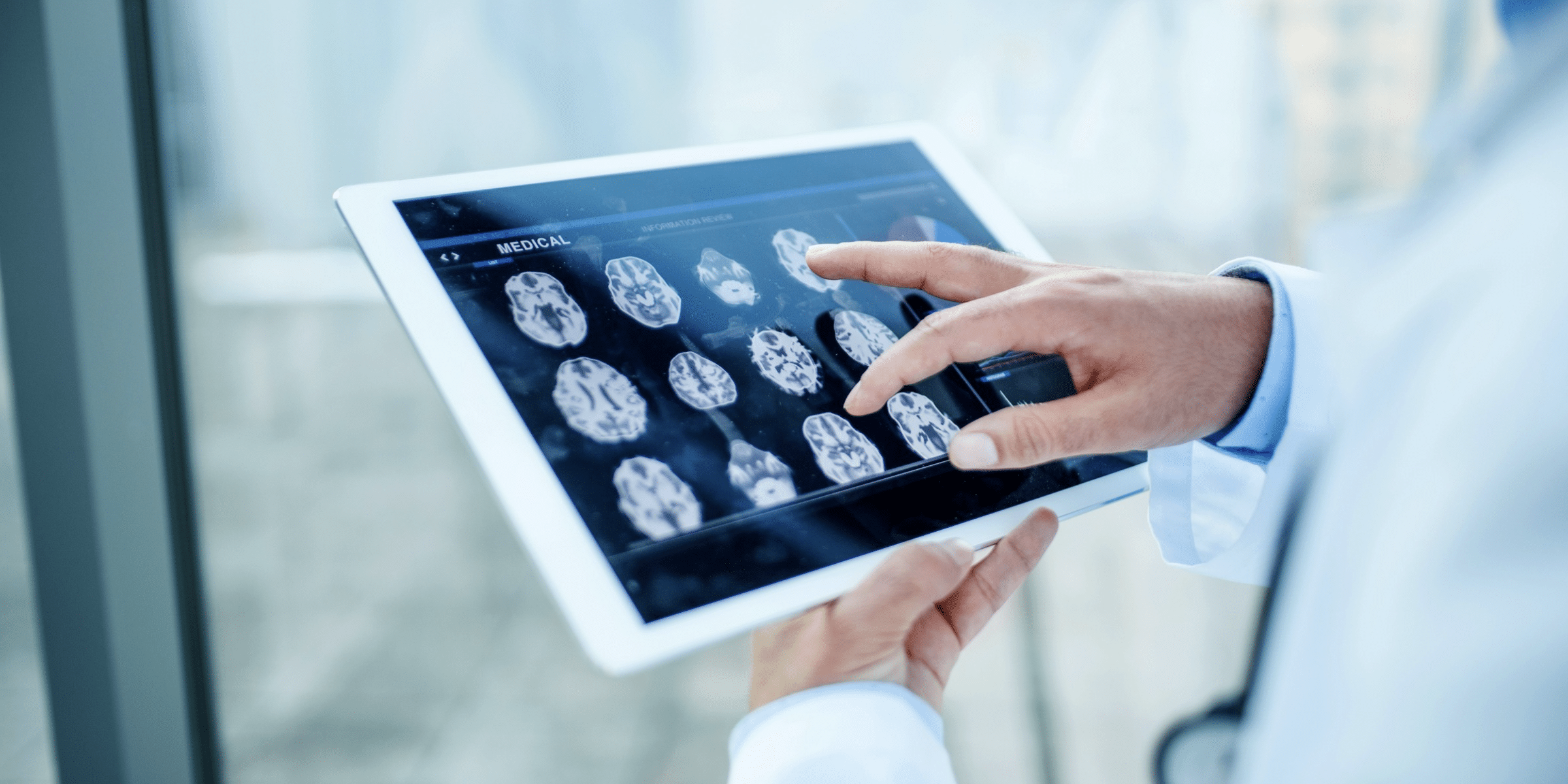 Transforming Medical Diagnosis: The Role of AI Technology