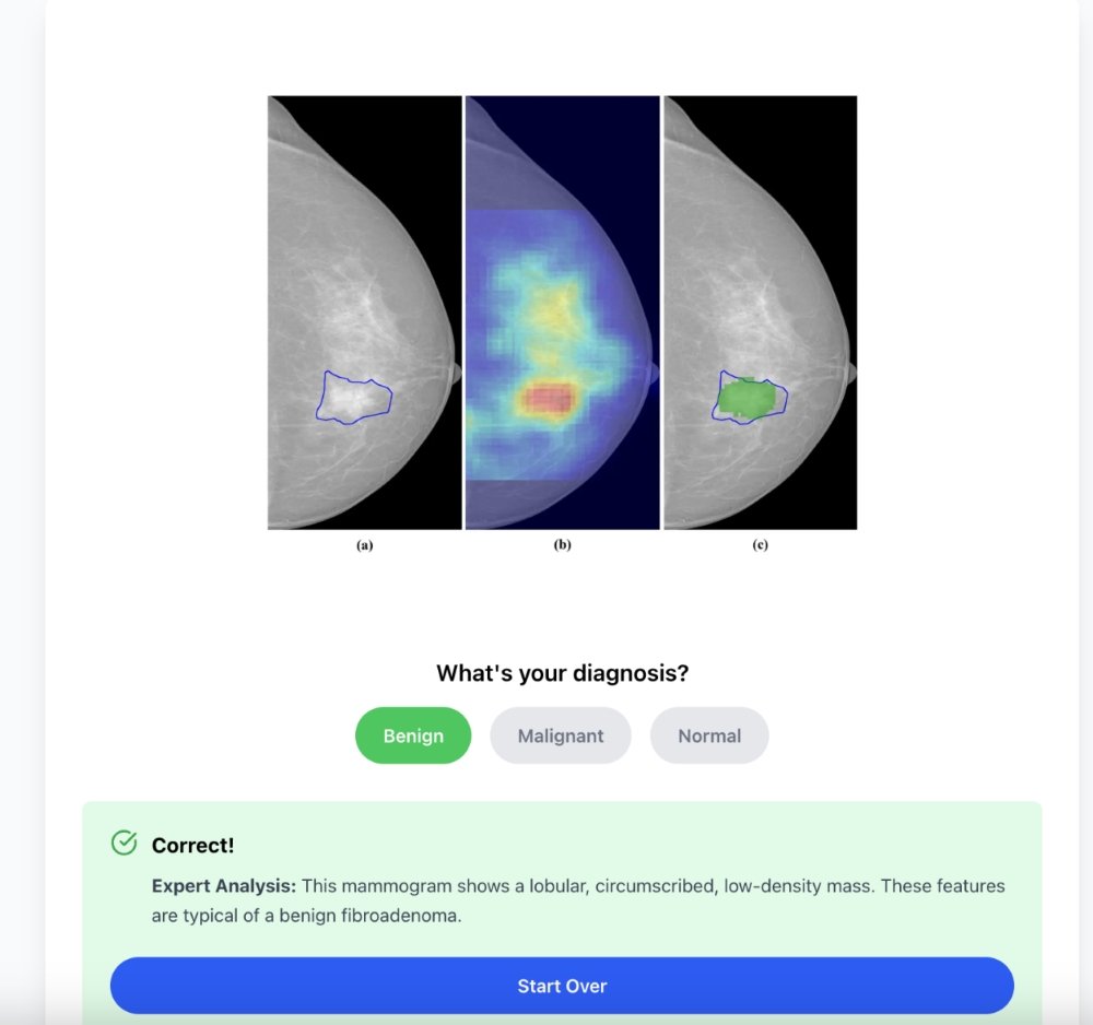 San Jose Teen Develops AI Platform to Combat Breast Cancer Crisis in Rural China